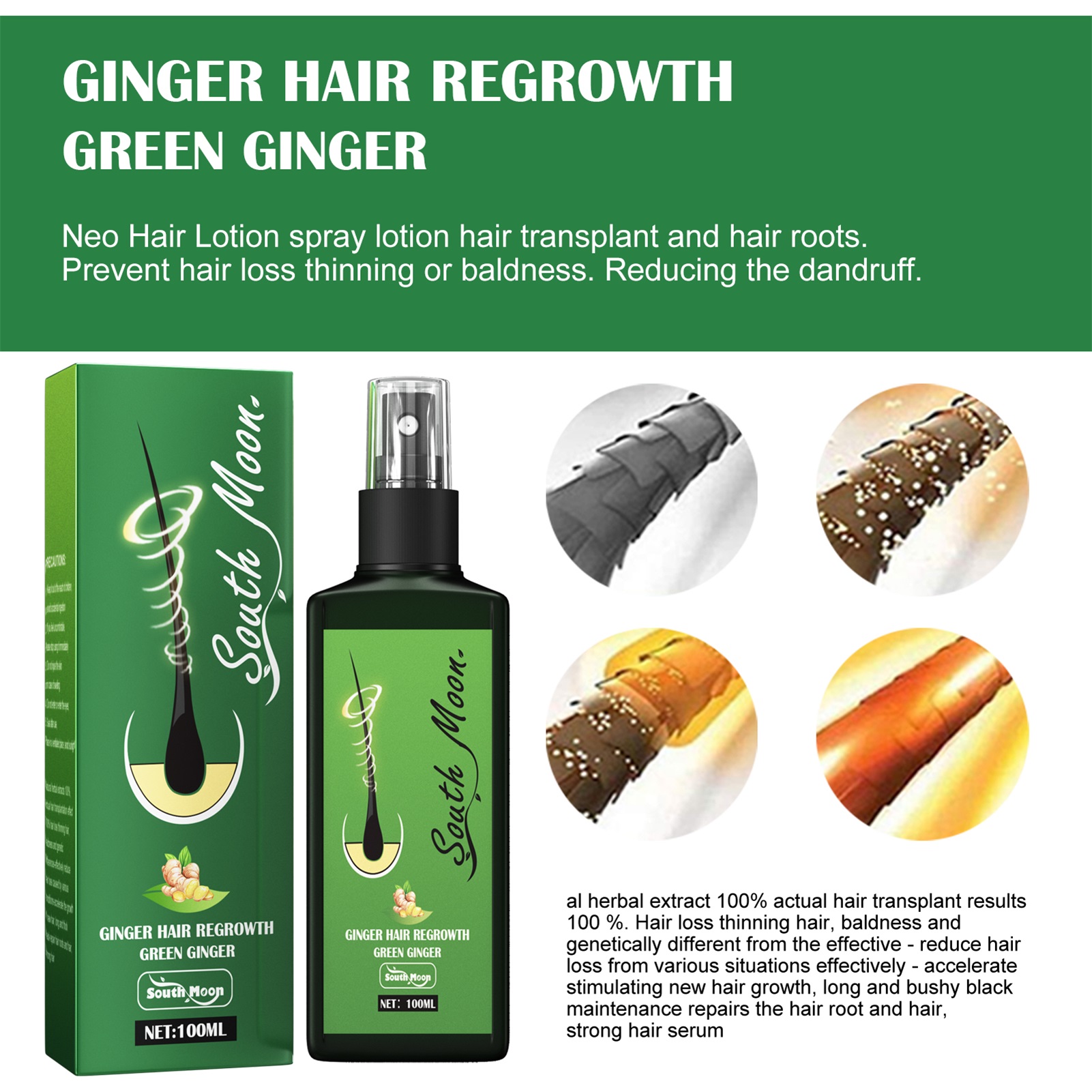 100ml-Hair-Growth-Serum-Hair-Lotion-Anti-Hair-Loss-Herbal-HairReBirth-Essence-Spra-Y-Serum-Ginger (1)
